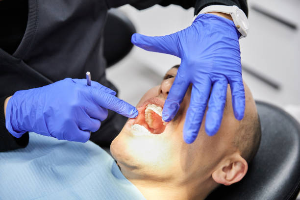 Best Emergency Root Canal Treatment in Lino Lakes, MN