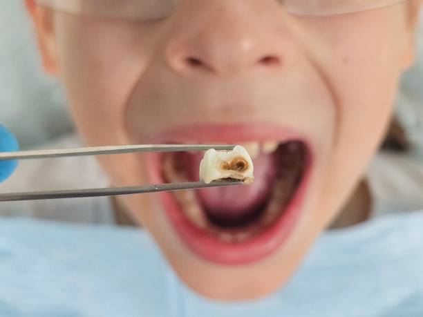 Best Emergency Dental Surgery in Lino Lakes, MN